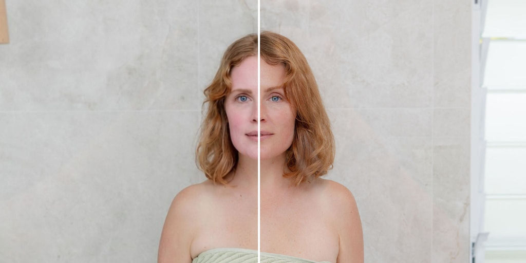 Why Your Skin Barrier Is the Real MVP